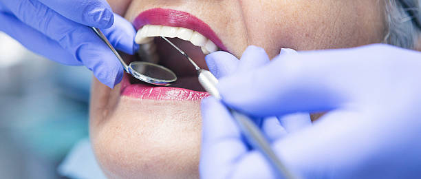 Best Emergency Treatment for Oral Infections in Pasadena, MD